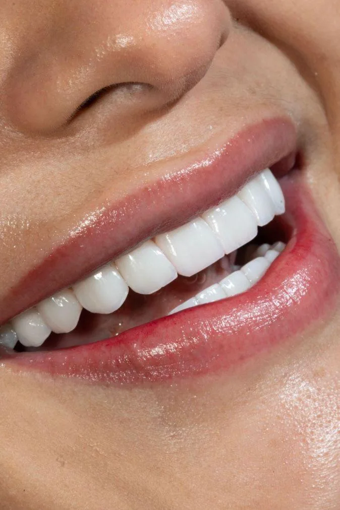 Paciente Smiluxe sonriendo