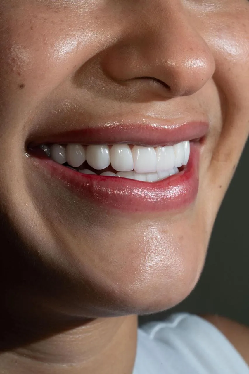 Paciente Smiluxe — resultado final